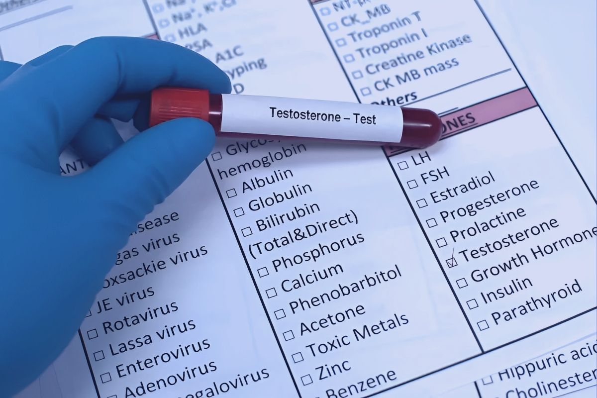 Jak zbadać testosteron – kiedy i gdzie wykonać badanie?